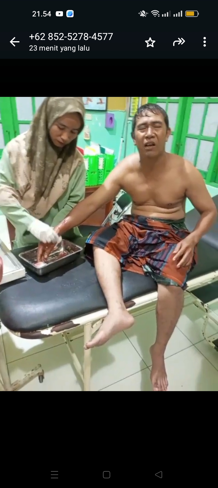 Diserang Buaya saat Berwudhu di Sungai, Warga Bagendang Tengah Dapat 15 Jahitan 