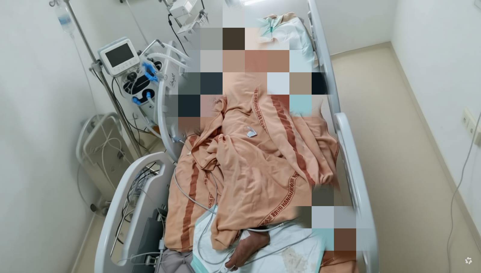 Korban Pembakaran di Pangkalan Banteng Meninggal Dunia, Pelaku Terancam Hukuman Lebih Berat